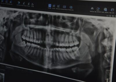 Radiografia dentale