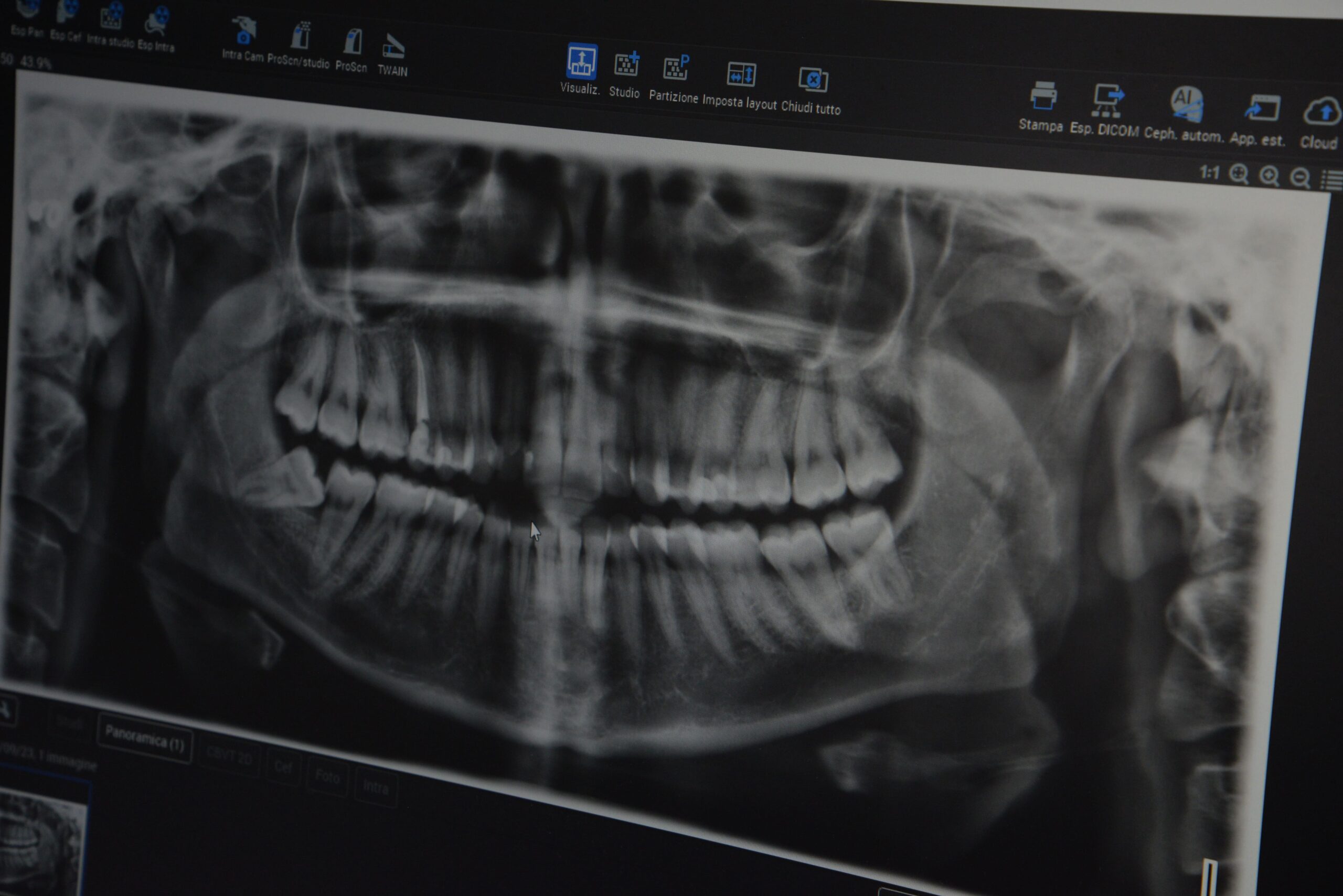 Radiografia dentale