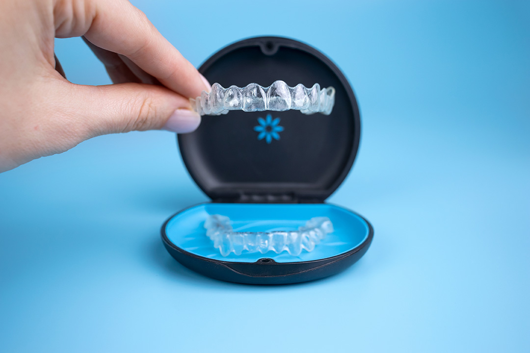 Apparecchio di mantenimento Invisalign